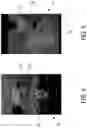 Fig. 05 - COMPUTED TOMOGRAPHY SYSTEM