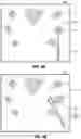 Fig. 07 - Automatic ablation antenna segmentation from CT image