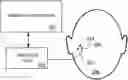 Fig. 01 - Semiautomated robotic cochlear implant surgery