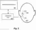 Fig. 03 - Semiautomated robotic cochlear implant surgery
