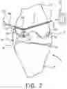 Fig. 08 - System and technique for accessing extra articular lesions or abnormalities or intra osseous lesions or bone marrow lesions