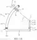 Fig. 15 - System and technique for accessing extra articular lesions or abnormalities or intra osseous lesions or bone marrow lesions