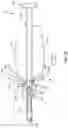 Fig. 25 - Spinal implant system and method