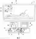 Fig. 02 - Catheter control system and graphical user interface