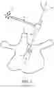 Fig. 02 - COMPLIANT END-EFFECTOR FOR IMAGE GUIDED SURGICAL PROCEDURES