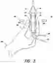 Fig. 03 - Detachable Finger-Activated Surgical Control Device