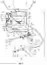 Fig. 02 - Hysteroscopy systems and methods for managing patient fluid