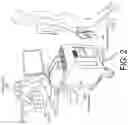 Fig. 03 - Aligning pre-operative scan images to real-time operative images for a mediated-reality view of a surgical site