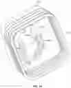 Fig. 09 - BIOMIMETIC DEVICE FOR MANIPULATION OF SOFT TISSUE
