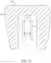 Fig. 12 - ARTIFICIAL TOOTH WITH MULTIPLE INTERNAL CROWNS  AND SPRING CLIP