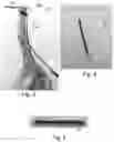 Fig. 04 - Electrical impedance sensing dental drill system configured to detect cancellous-cortical bone and bone-soft tissue boundaries