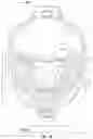 Fig. 03 - DENTAL RETRACTION DEVICE