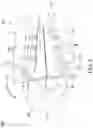 Fig. 06 - Vibration device for dental use and orthodontic correction method
