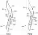 Fig. 10 - Removable dental appliance including positioning member
