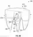 Fig. 13 - Removable dental appliance including positioning member