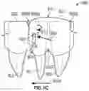 Fig. 15 - Removable dental appliance including positioning member