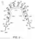 Fig. 03 - Dental appliances, systems and methods