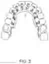 Fig. 04 - Dental appliances, systems and methods