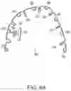 Fig. 10 - Dental appliances, systems and methods