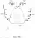 Fig. 12 - Dental appliances, systems and methods
