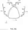 Fig. 13 - Dental appliances, systems and methods