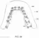 Fig. 43 - Dental appliances, systems and methods