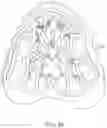 Fig. 44 - Dental appliances, systems and methods