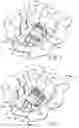 Fig. 07 - Packaged orthodontic appliances
