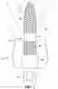 Fig. 02 - Dental implant system