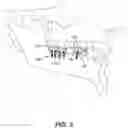 Fig. 03 - Dental implant system