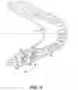 Fig. 04 - Dental implant system