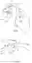Fig. 10 - Dental zirconia system