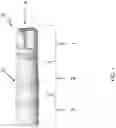 Fig. 02 - Dental implant analog
