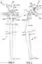 Fig. 02 - Dental floss device