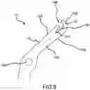 Fig. 06 - Dental floss device