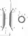 Fig. 04 - Suction stent, stent system, and method for sealing a leakage