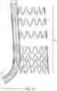 Fig. 05 - Endovascular systems, devices, and methods allowing for branch device placement in channel of main graft