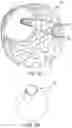 Fig. 13 - Endovascular systems, devices, and methods allowing for branch device placement in channel of main graft
