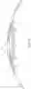 Fig. 15 - Endovascular systems, devices, and methods allowing for branch device placement in channel of main graft