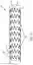 Fig. 19 - Endovascular systems, devices, and methods allowing for branch device placement in channel of main graft
