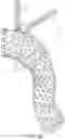 Fig. 24 - Endovascular systems, devices, and methods allowing for branch device placement in channel of main graft