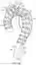 Fig. 29 - Endovascular systems, devices, and methods allowing for branch device placement in channel of main graft