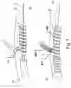 Fig. 06 - Stent-graft prosthesis, system and method for improved delivery of a stent-graft prosthesis