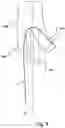 Fig. 07 - Stent-graft prosthesis, system and method for improved delivery of a stent-graft prosthesis