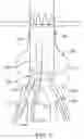 Fig. 07 - Bifurcating branch modular iliac branch device