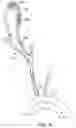 Fig. 06 - SYSTEMS AND METHODS FOR TRANSCATHETER AORTIC VALVE TREATMENT