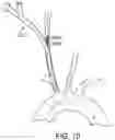 Fig. 08 - SYSTEMS AND METHODS FOR TRANSCATHETER AORTIC VALVE TREATMENT