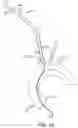 Fig. 11 - SYSTEMS AND METHODS FOR TRANSCATHETER AORTIC VALVE TREATMENT