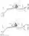 Fig. 15 - SYSTEMS AND METHODS FOR TRANSCATHETER AORTIC VALVE TREATMENT