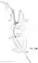 Fig. 17 - SYSTEMS AND METHODS FOR TRANSCATHETER AORTIC VALVE TREATMENT